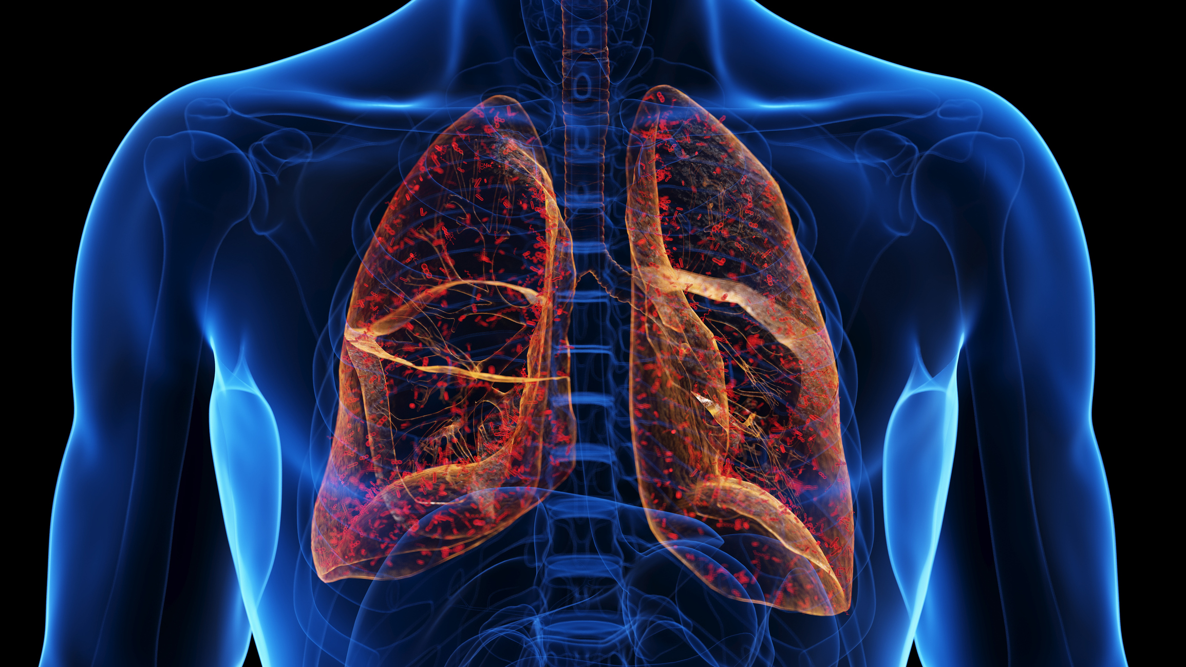 Appolon Bioteck, RespiGUARD4plex, Kit PCR temps réel, Virus de la grippe A et B, SARS-CoV-2, VRS